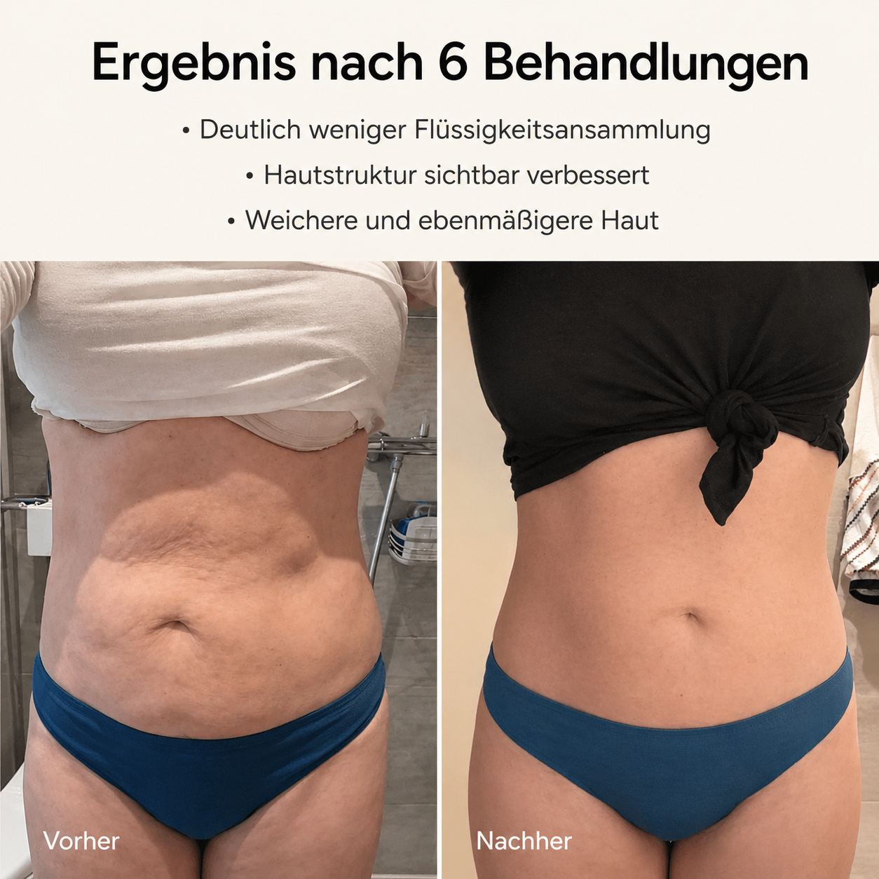 Anti-Cellulite - Glatte Haut in 14 Tagen