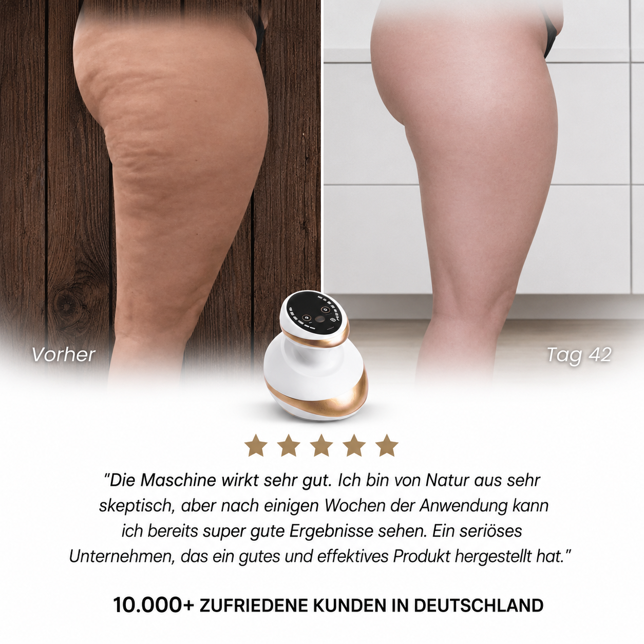 Anti-Cellulite - Glatte Haut in 14 Tagen