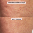 Princess Skin - Zeig Haut, in der du dich wohlfühlst.